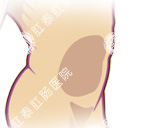 腹泻应重视进行科学检查,防止疾病恶化!