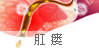 肛瘘