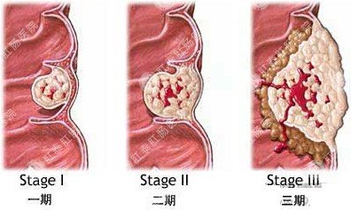 福州肛肠医院