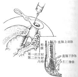 福州肛肠医院