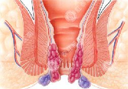 福州肛肠医院
