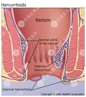 福州肛肠医院