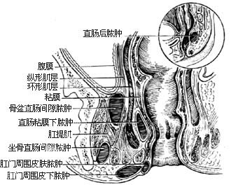 福州肛肠医院