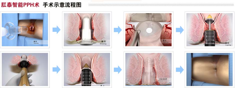 福州肛肠医院