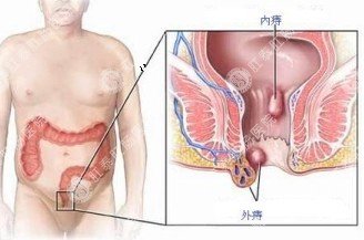 福州肛肠医院