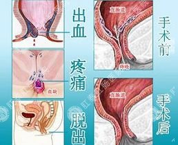 福州肛肠医院