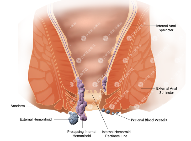 福州肛肠医院