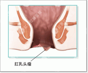 福州肛肠医院