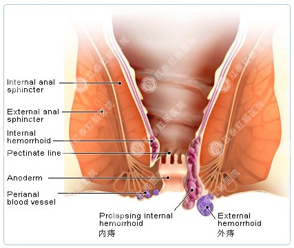 福州肛肠医院