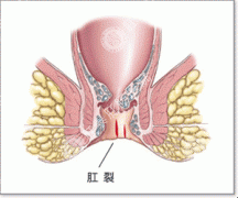 福州肛肠医院