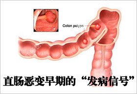 福州肛肠医院