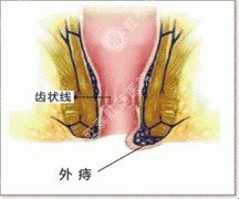 福州肛肠医院