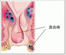 福州肛肠医院