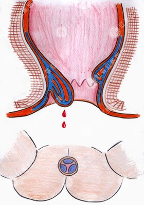 福州肛肠医院