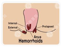 福州肛肠医院