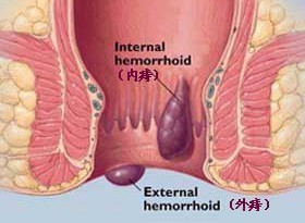 福州肛肠医院