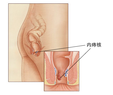 福州肛肠医院