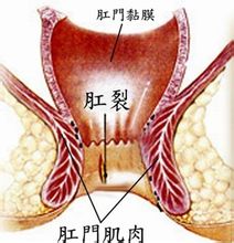 福州肛肠医院