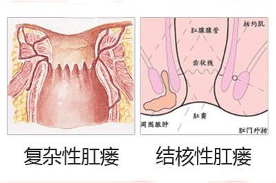 福州肛肠医院