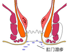 福州肛肠医院 福州医博肛肠医院 福州看痔疮的医院 福州肛瘘医院 福州肛裂医院 福州肠炎医院