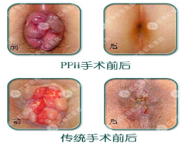 福州肛肠医院