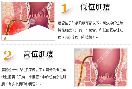 福州肛肠医院