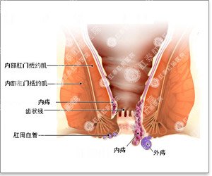 福州肛肠医院