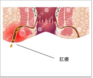 福州肛肠医院