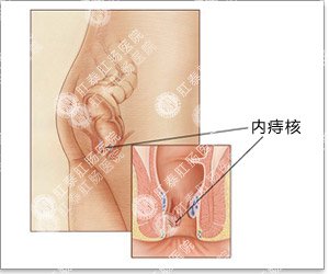 福州肛肠医院