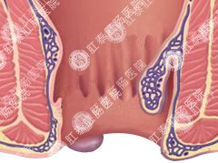福州肛肠医院