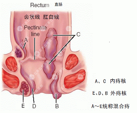 肛门齿线的位置科普图解