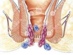 福州肛肠医院