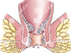 福州肛肠医院