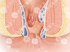 福州肛肠医院