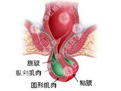 福州肛肠医院