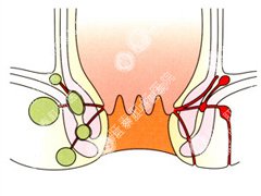 福州肛肠医院