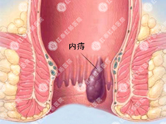 福州肛肠医院