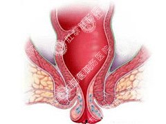 福州肛肠医院