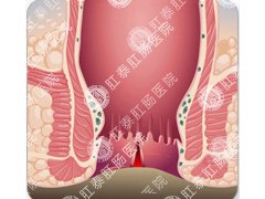 福州肛肠医院