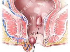 福州肛肠医院