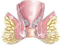 福州肛肠医院