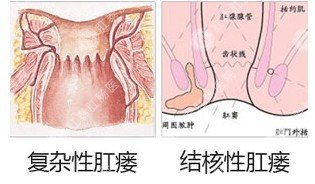 福州肛肠医院