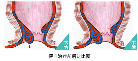 福州肛肠医院