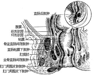 肛周瘙痒“报到” 或是标志