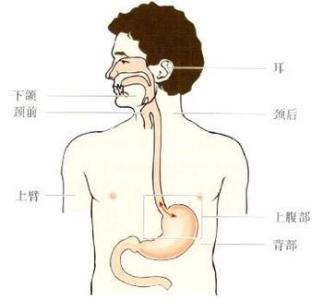 胃下垂的护理方法 胃下垂的典型症状