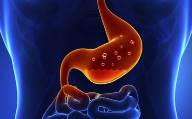 急性胃炎怎么治疗 引发急性胃炎的病因