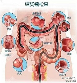 福州肛肠医院 福州医博肛肠医院 福州看痔疮的医院 福州肛瘘医院 福州肛裂医院 福州肠炎医院