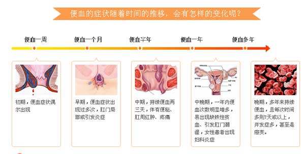 福州哪家医院治疗便血好