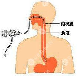 福州肛肠医院 福州医博肛肠医院 福州看痔疮的医院 福州肛瘘医院 福州肛裂医院 福州肠炎医院