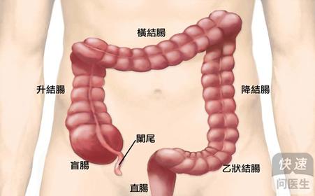 福州已状结肠炎治疗医院在哪里